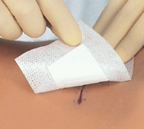SMITH & NEPHEW S66001478 Cutiplast Sterile Dressing 7.2cm x 5cm Box of 100